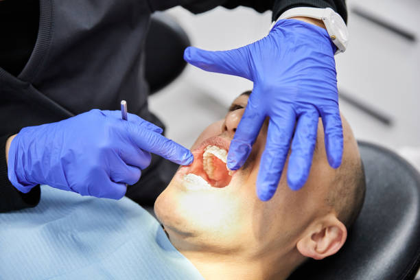 Best Broken or Chipped Tooth Repair in John Day, OR